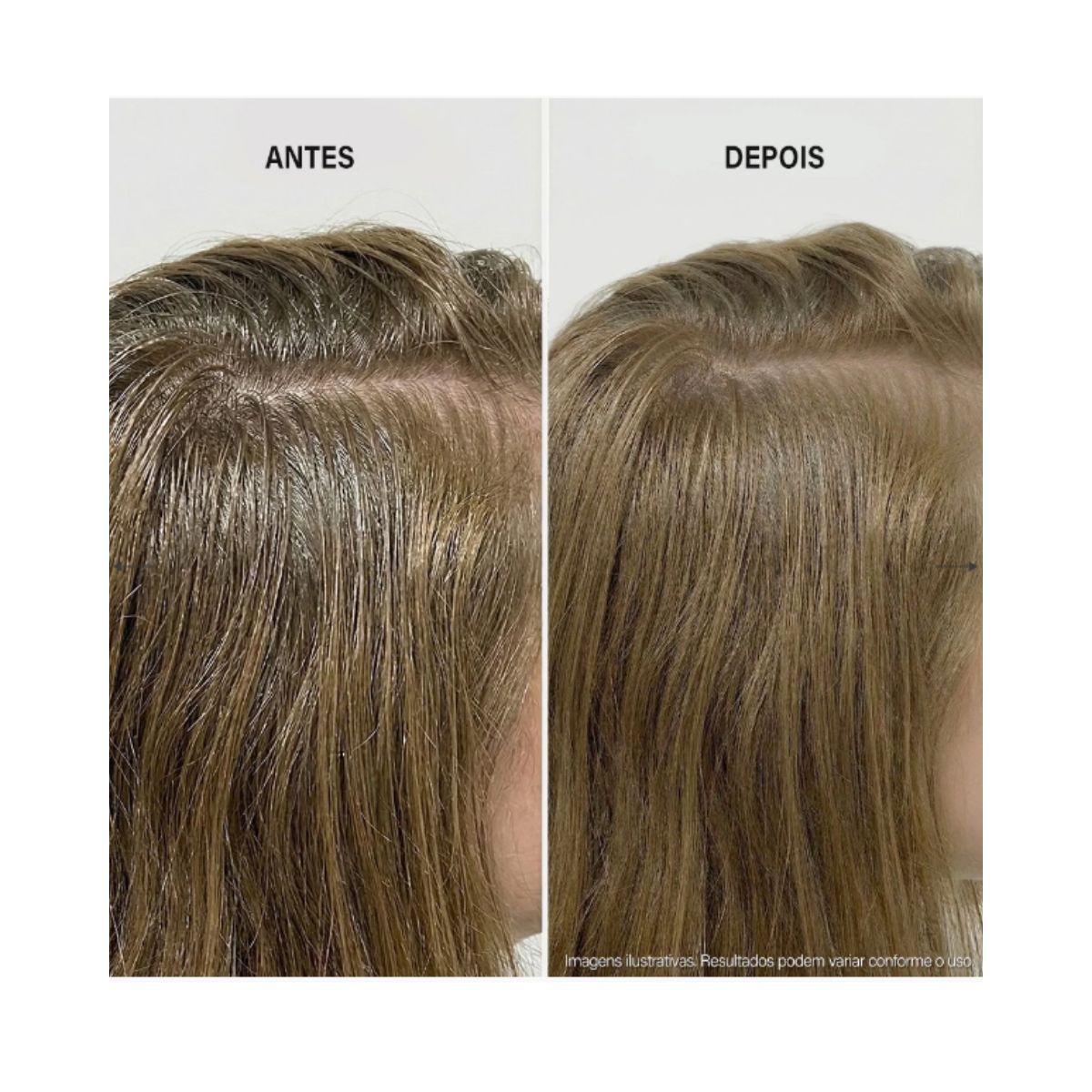 SHAMPOO CARE DERMA REGULATE KEUNE 300ML