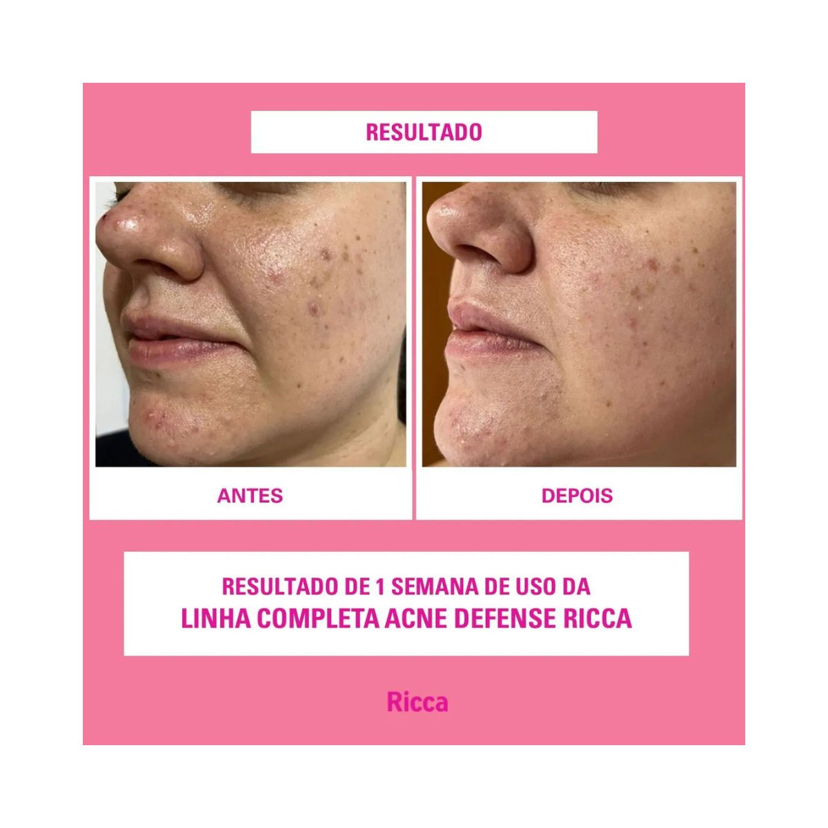 SÉRUM FACIAL NIACINAMIDA RICCA 30ML 3798
